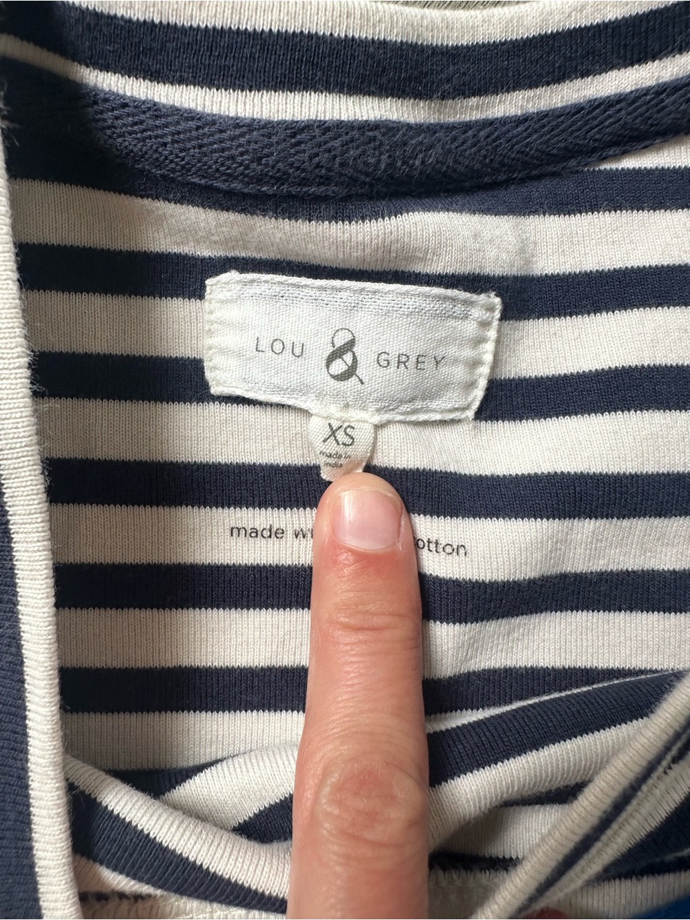 Striped Cotton Shirt Dress Bundle - Picture 3 of 5